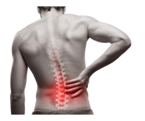 الانزلاق الغضروفي