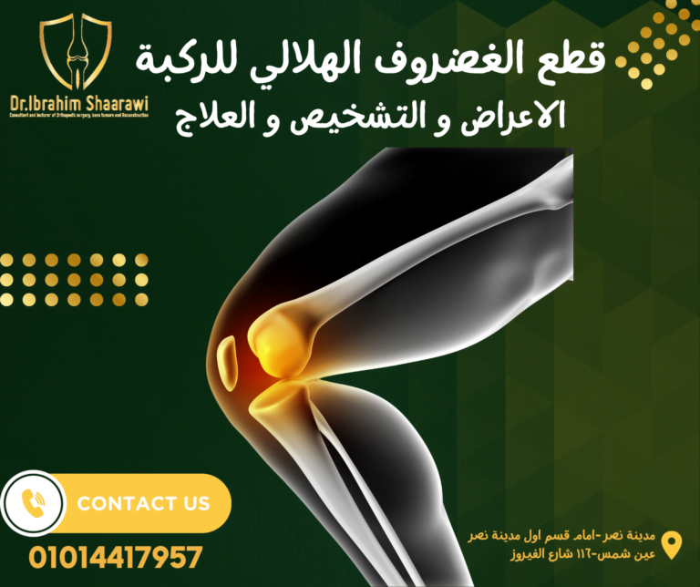 قطع الغضروف الهلالي للركبة