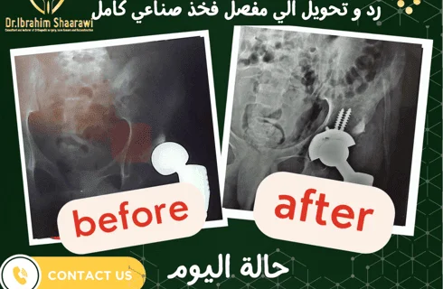 دكتور عظام ممتاز