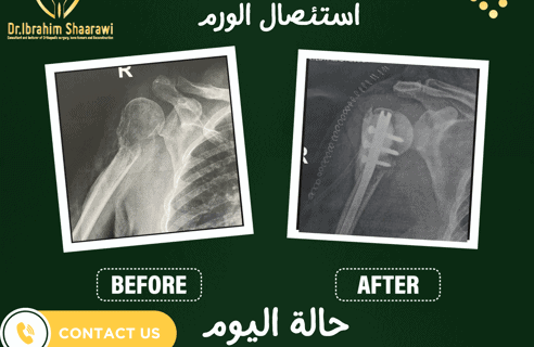دكتور عظام ممتاز 2025 دكتور عظام ممتاز 2025