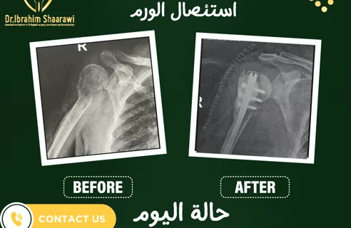 دكتور عظام ممتاز
