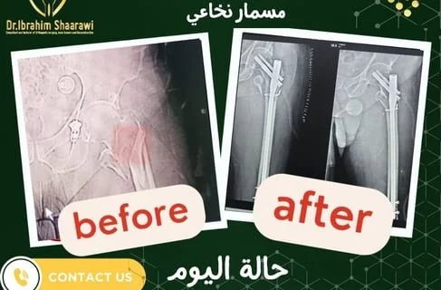 دكتور عظام ممتاز