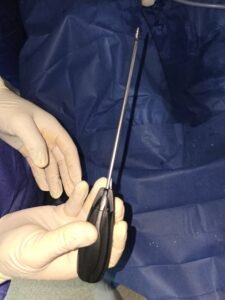 شكل خطاف الكتف