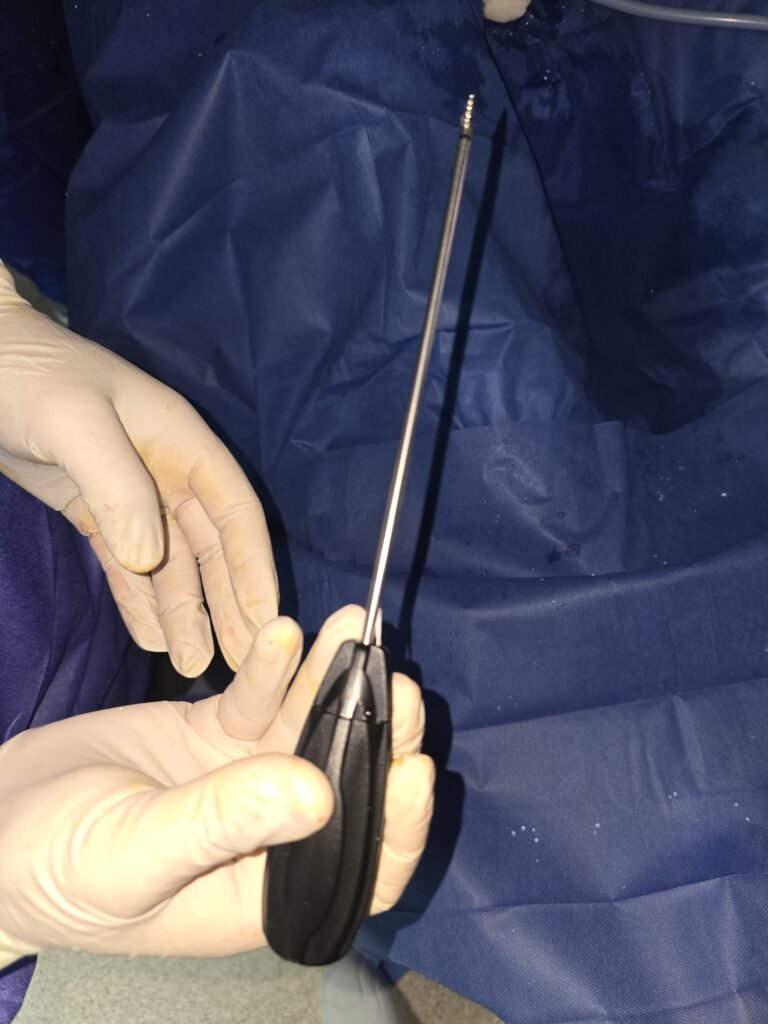 شكل خطاف الكتف