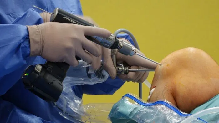 Arthroscopic shoulder surgery to assess a rotator cuff tear