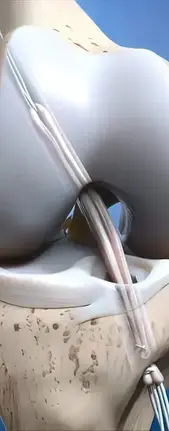 افضل دكتور عملية رباط صليبي