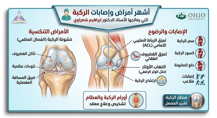 أشهر أمراض وإصابات الركبة التي يعالجها استاذ دكتور ابراهيم شعراوي