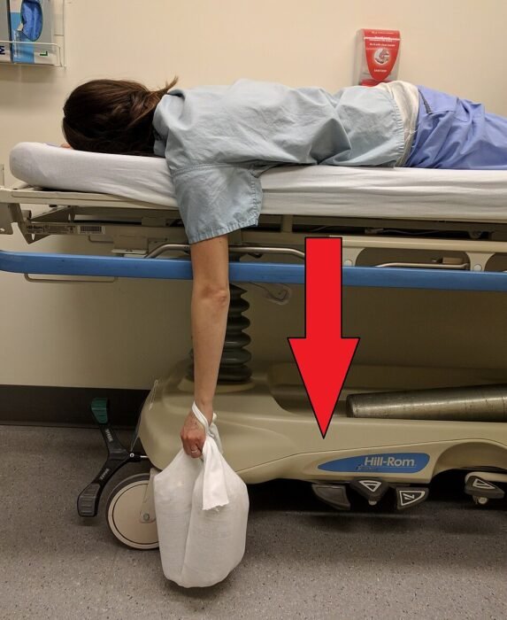 Stimson technique for reducing a dislocated shoulder: patient lying face down with the arm hanging and a light weight
