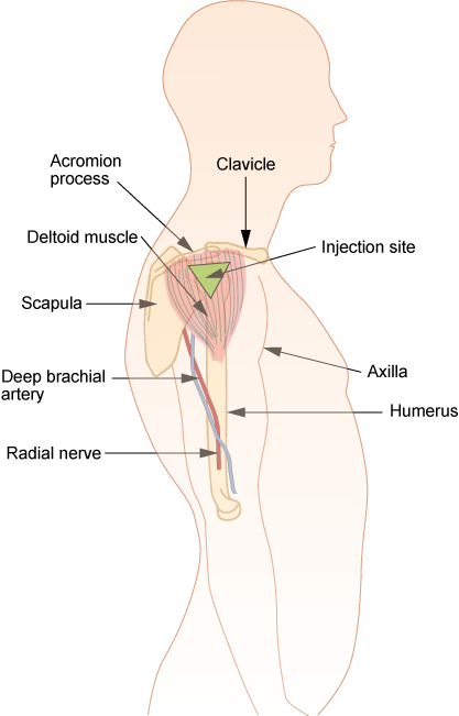 Deltoid intramuscular injection site used for vitamin D injections